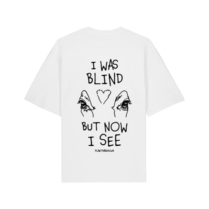 I was Blind - Oversized T-Shirt